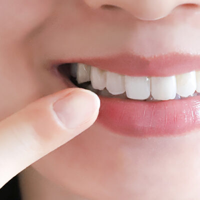 審美歯科｜船津歯科クリニック｜佐賀