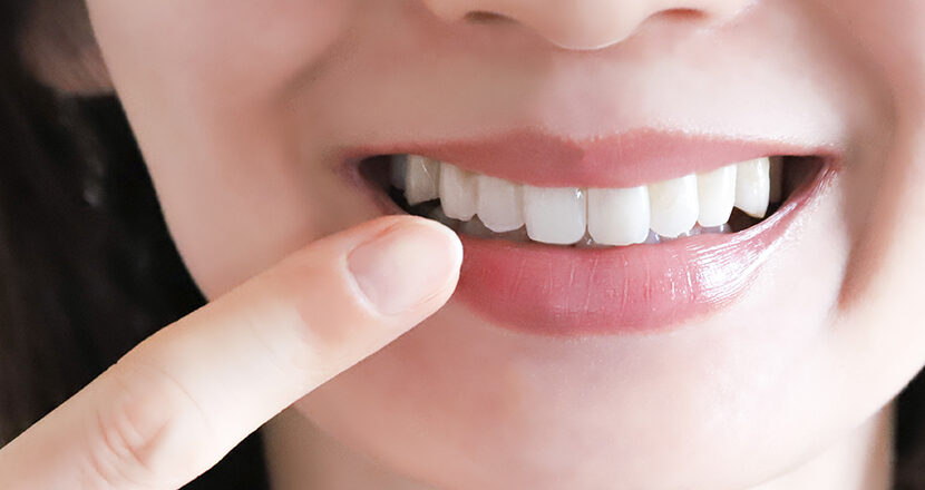 審美歯科｜船津歯科クリニック｜佐賀