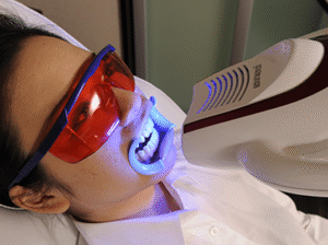 審美歯科｜ホワイトニング｜施術の様子｜船津歯科クリニック｜佐賀