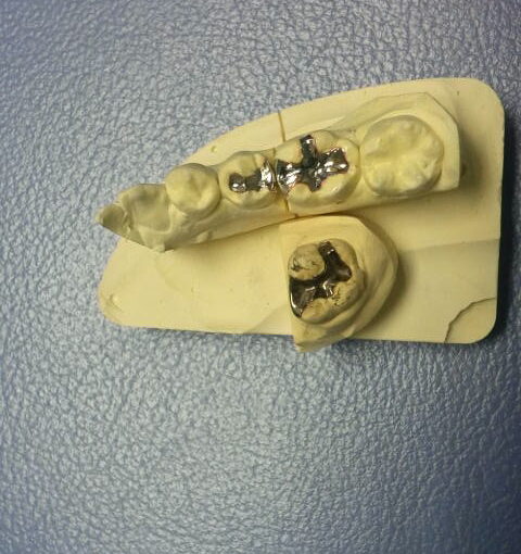 院長ブログ｜佐賀｜船津歯科クリニック