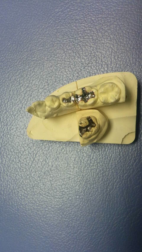 院長ブログ|佐賀|船津歯科クリニック