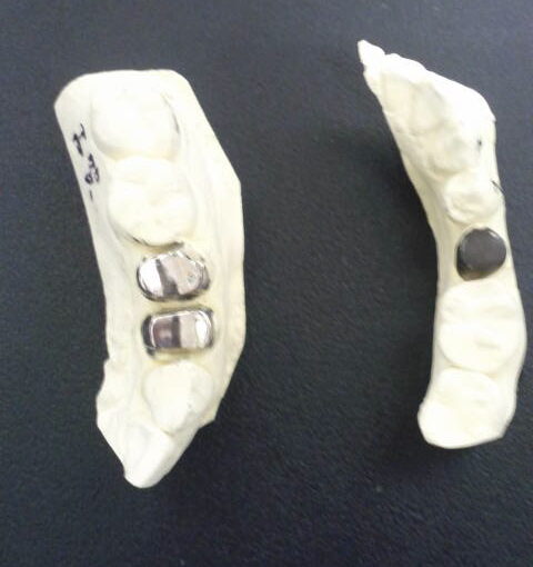 院長ブログ｜佐賀｜船津歯科クリニック