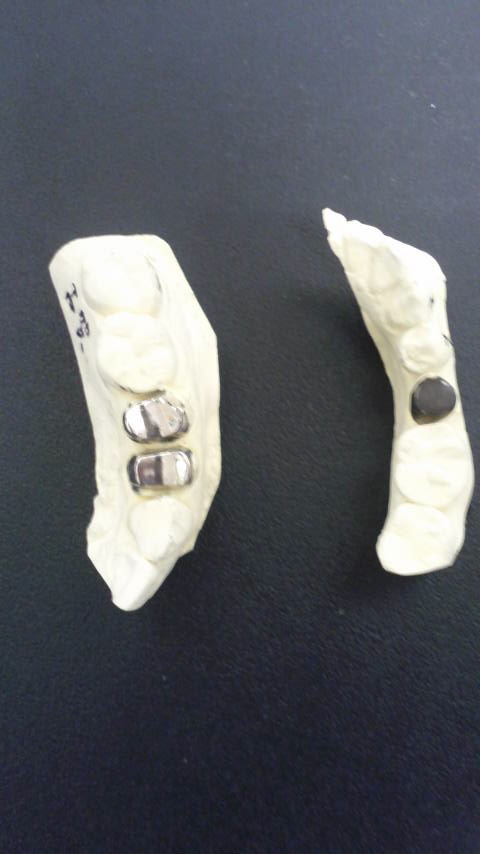 院長ブログ｜佐賀｜船津歯科クリニック