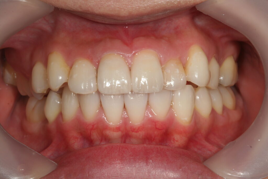 院長ブログ｜佐賀｜船津歯科クリニック