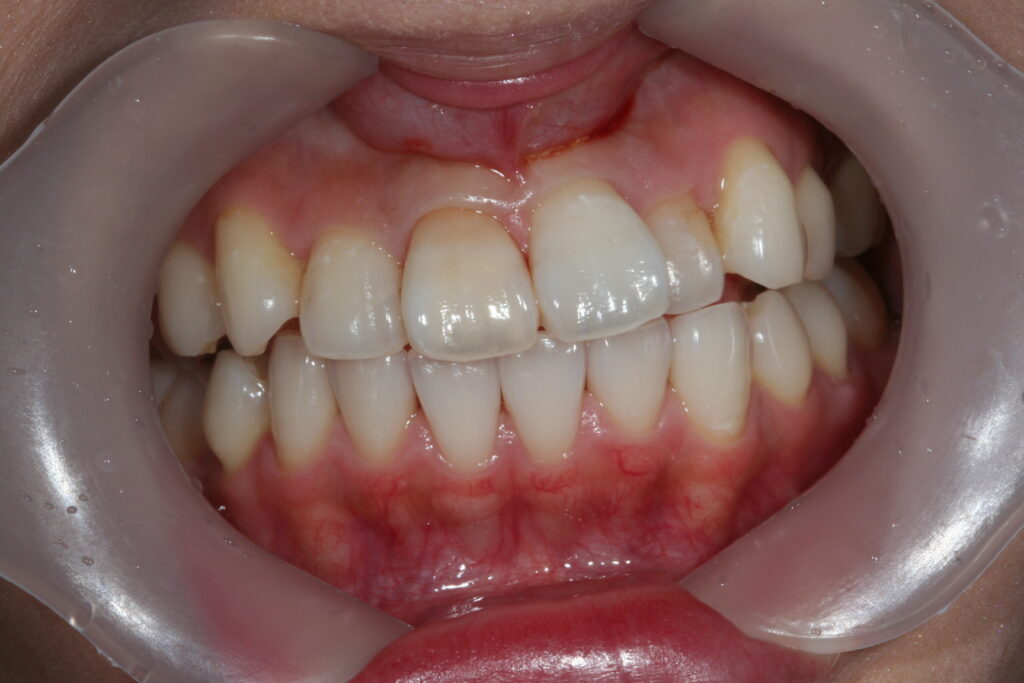 院長ブログ｜佐賀｜船津歯科クリニック