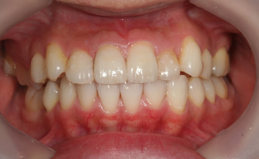 院長ブログ｜佐賀｜船津歯科クリニック