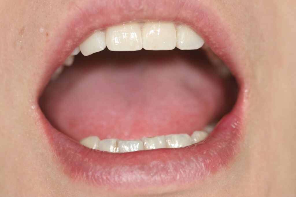 院長ブログ｜佐賀｜船津歯科クリニック