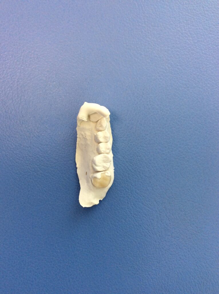 院長ブログ｜佐賀｜船津歯科クリニック