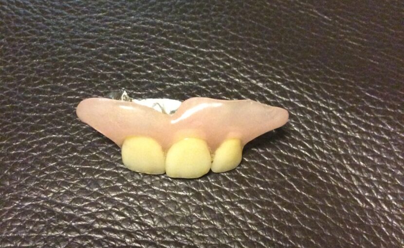 症例紹介｜審美歯科｜佐賀｜船津歯科クリニック